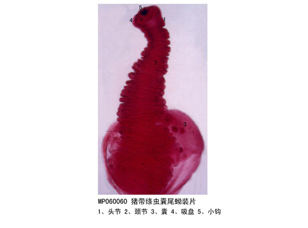豬帶絛（tāo）蟲囊尾蚴裝片