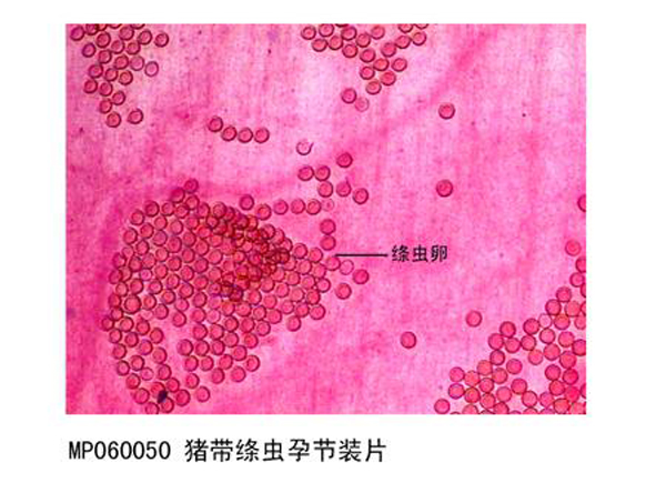豬帶絛蟲孕節裝片