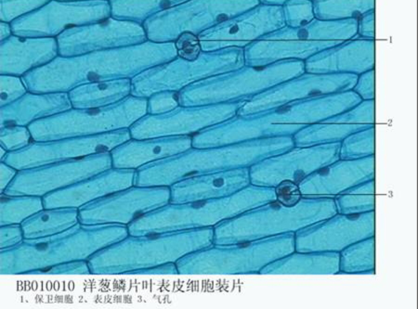 Onion epidemis cell w.m.