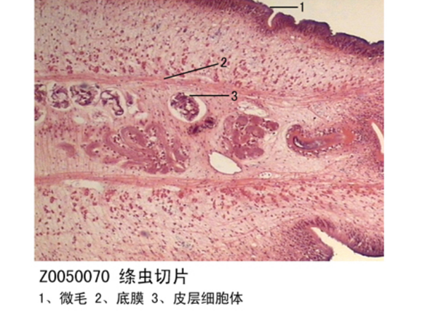 絛蟲切片