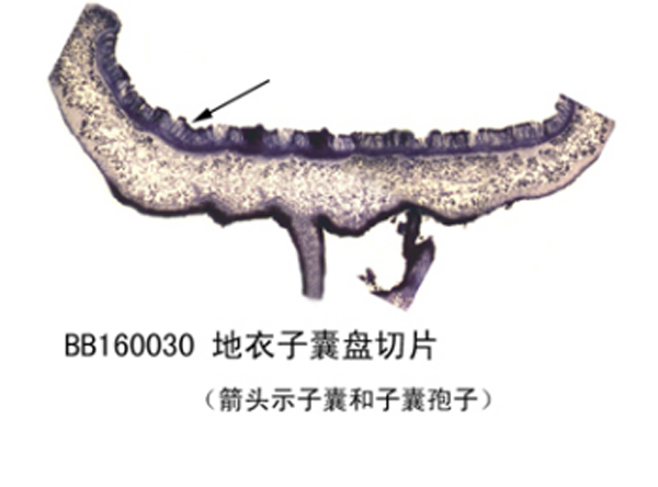 地衣子囊盤切片（piàn）