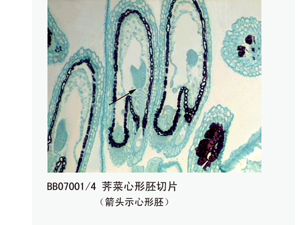 薺菜心形（xíng）胚切片