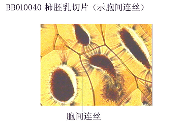 柿（shì）胚乳切片（示胞間連絲（sī）)
