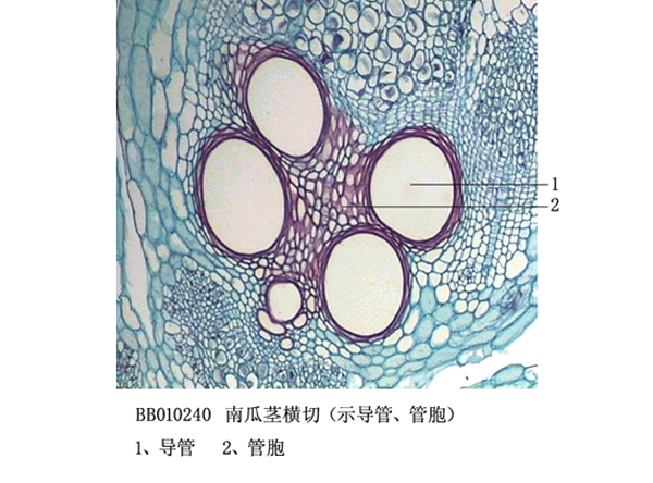 舟（zhōu）瓜莖橫切（示導管、管胞（bāo）)